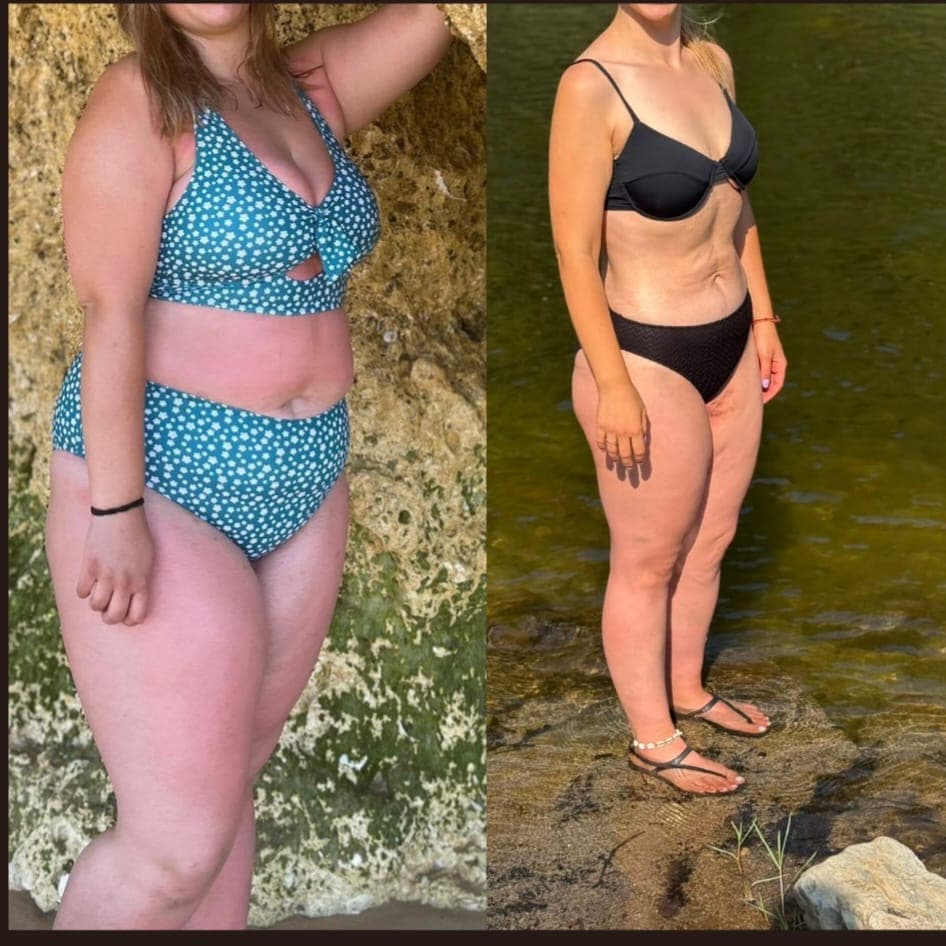 Fotografia antes e depois da Sara Silva